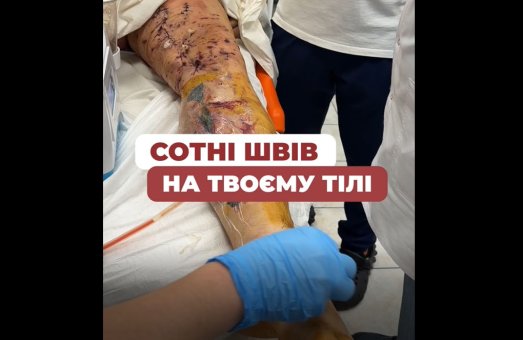 Їх збирають буквально по шматочках… Але вони усміхаються ❤️🩹