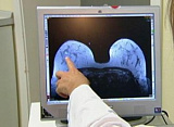 Мамографія в 2 проекціях двох молочної залози