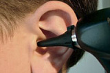 Катетеризація слухової труби з веденням ліків